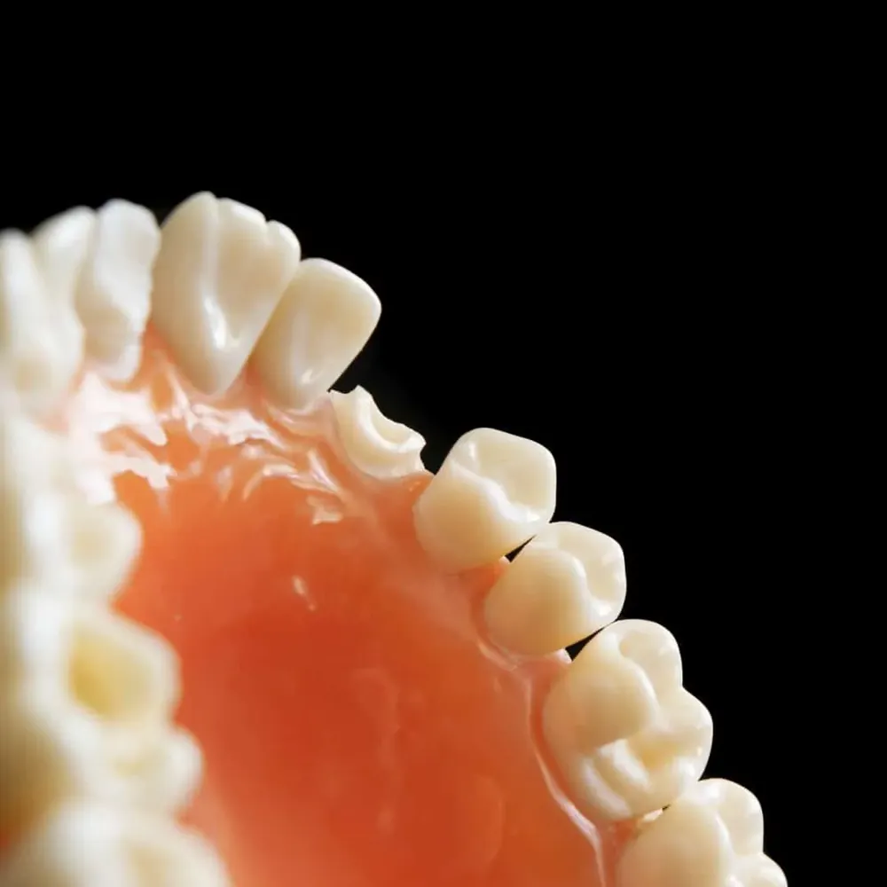 Implantes dentales en Puerto Montt &mdash; Cl&iacute;nica Monteverde